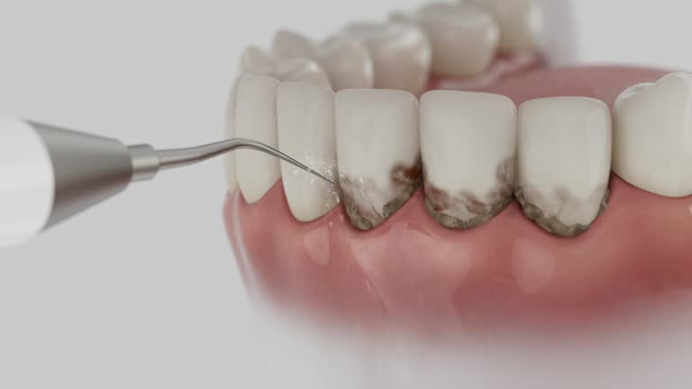 Trusted Dental Implants service in Bristol, IN - Dentist Open Now
